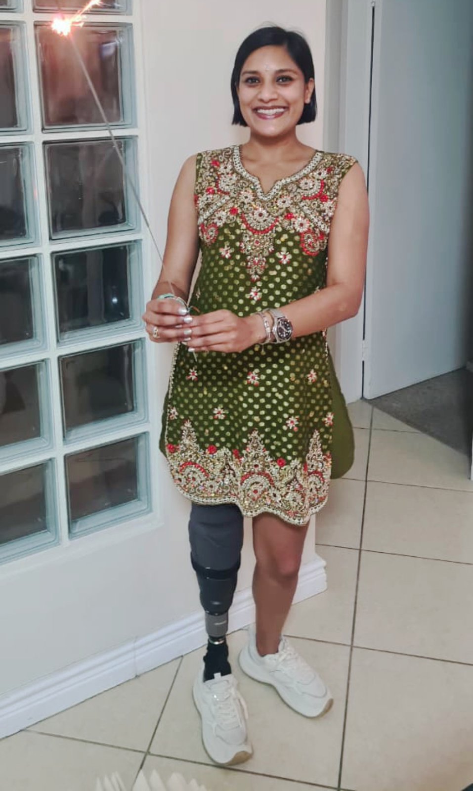 Shay fashion Shay dressed for a function showing her healed prosthetic leg.